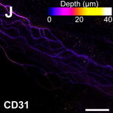 CD31 2