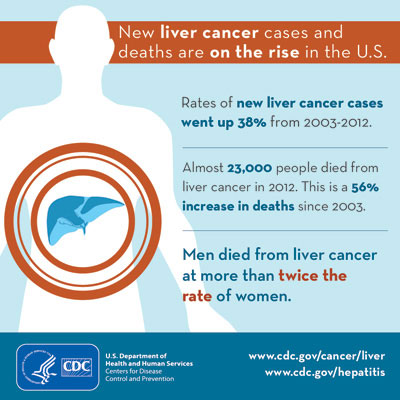 liver cancer on rise 400